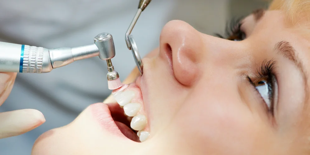 limpieza dental